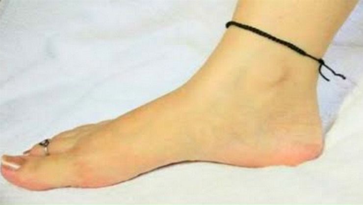 black rop in feet, கருப்பு கயிறு, காலில் கருப்பு கயிறு,